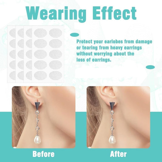 Earlobe Support Patches